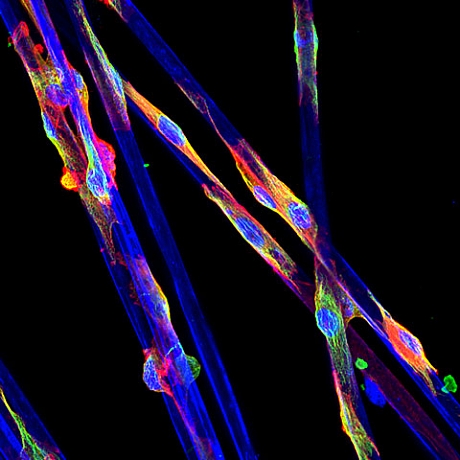 　2500倍に拡大された超極細合成繊維に付く内皮細胞。テキサス大学Southwestern Medical CenterのYongli Shan氏が撮影。