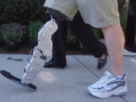 思考で制御できるバイオニック義足--急速に進化する義肢技術