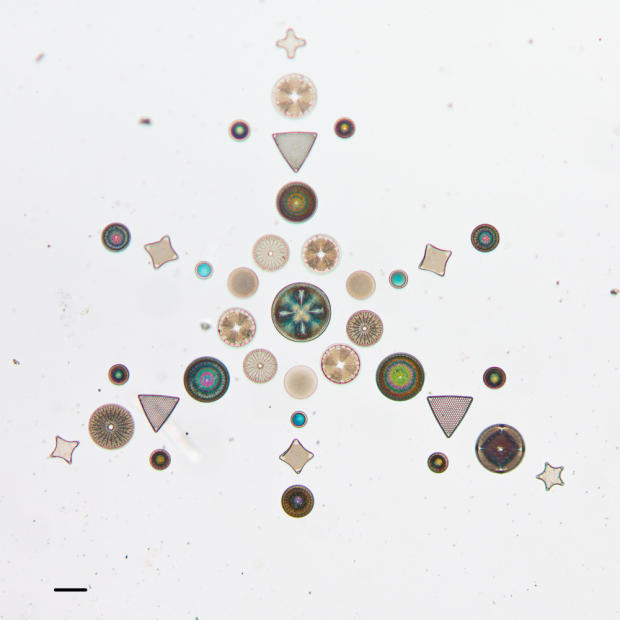 　「Prize Medal Paris 1867 Diatomaceae」というラベルのついたスライドガラスに配置されたケイ藻の写真。