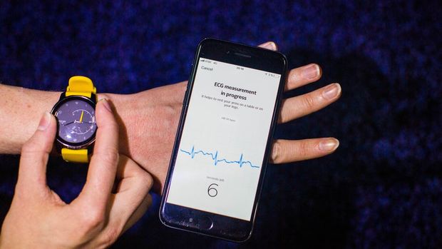 　Withingsの最新のフィットネスウォッチは、心房細動の兆候を探してくれる心電図機能を備えている。同様の機能を利用できる、399ドル（約4万3000円）の「Apple Watch Series 4」の約3分の1の価格だが、米食品医薬品局（FDA）の承認はまだ下りていない。