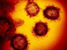 新型コロナウイルスのタンパク質、初の3Dマップ公開--ワクチン開発の足がかりに