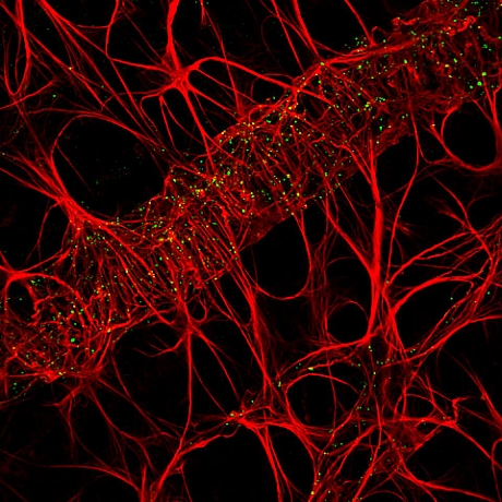 　100倍に拡大されたネズミの網膜血管網。Cameron Johnson氏が撮影。