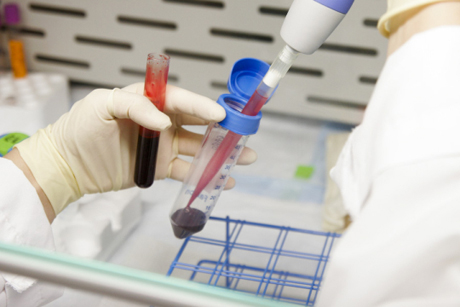 　バイオテクノロジ研究室の1つでは、科学者が血液中のがん細胞を検出する技術を研究しているところだ。