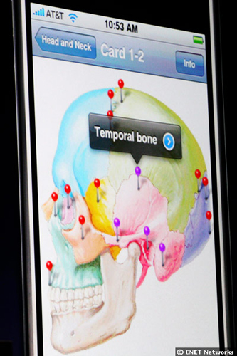 　iPhoneで医療情報を扱うためのアプリケーションも紹介された。