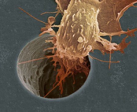 　ガンの細胞運動。これはガンの治療法を研究するCancer Research UKで写された。