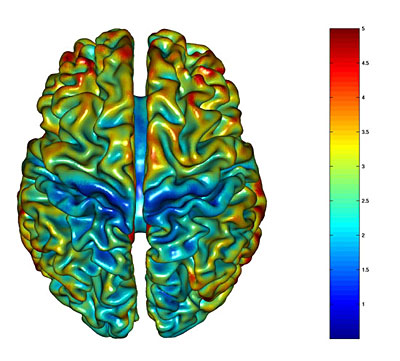 　脳灰白質は脳内の特定の部位に固まって存在する傾向がある。写真では、赤く表示されている部分ほど脳灰白質が厚く集まっていることを意味する。逆に、青く表示されているほど、脳灰白質の層が薄い。