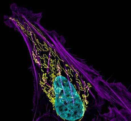 　63倍に拡大した、ヒトの骨肉腫の珍しい画像。紫色がアクチンフィラメント、黄色がミトコンドリア、青色がDNAだ。メリーランド州ベセスダにある米国国立衛生研究所のDylan Burnette博士が撮影。

　この画像は、2012年のNikon International Small World Photomicrography Competitionで第3位に入賞した。
