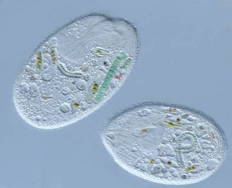 　400倍に拡大したソンデリア種の画像。繊毛のある原生生物で、さまざまな藻類やケイ藻、シアノバクテリアを餌にしている。ワシントンDCのジョージワシントン大学Department of Biological SciencesのDiana Lipscomb博士が撮影。

　この画像は、2012年のNikon International Small World Photomicrography Competitionで第13位に入賞した。
