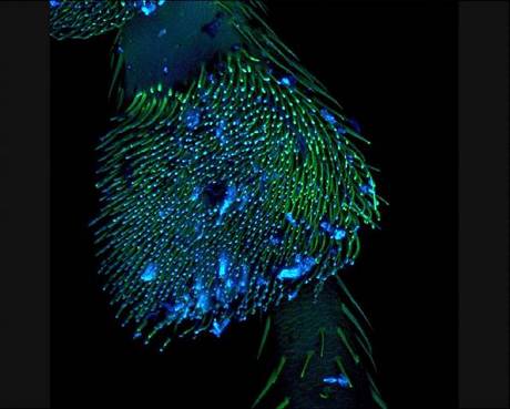 　10倍に拡大した、青と緑が美しいテントウムシの足。イタリア、トリノのトリノ大学Department of Life Sciences and Systems BiologyのAndrea Genre氏が撮影。

　この画像は、2012年のNikon International Small World Photomicrography Competitionで第15位に入賞した。
