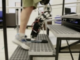 写真で見る思考制御型バイオニック義足--スムーズな動作を可能にする技術