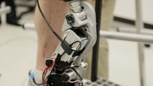 　RICはこの世界初の思考制御型バイオニック義足について、アルゴリズムを開発し研究を進めた。一方RICバイオニックチームが研究し、ボランティアのZac Vawter氏が使用した実際のハードウェアは、ヴァンダービルト大学が7年半の歳月をかけて設計したものだ。

　RICは、負傷した退役軍人の生活向上のために義肢の開発を促進する取り組みとして米陸軍から800万ドルの助成金を受け取り、Vawter氏による治験と、バイオニック義足のソフトウェアおよびハードウェアの改良を始めることができた。RICチームは今後3年から5年のうちに、このデバイスを家庭でテストする予定だとしている。
