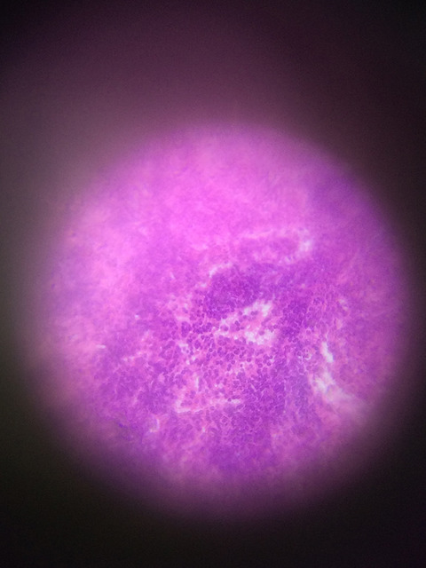 　脾臓の細胞組織を撮影。