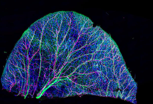 動物、植物、それとも鉱物？

　一見すると、葉の画像に見えるかもしれない。しかし、これはネズミの耳の皮膚の神経と血管を10倍に拡大して撮影した画像だ。

　米国立衛生研究所（NIH）のTomoko Yamazaki氏が共焦点顕微鏡法を使って、この写真を撮影した。
