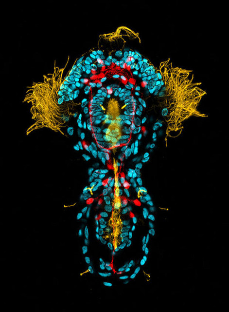 驚くべき虫

　ニコンのコンテストで選外佳作に選ばれたこの画像は、生後3日の星口動物の幼虫を40倍に拡大して撮影したもの。

　黄色い部分は星口動物の繊毛、青い部分はDNA、赤い部分は神経系のセロトニンだ。スミソニアン海洋センターのMichael J. Boyle氏が撮影した。
