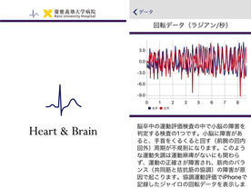 慶応大学、iPhoneアプリで国内初の臨床研究--データから不整脈や脳血栓の早期発見を