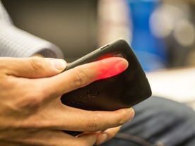 採血なしで貧血を検査するスマホアプリ「HemaApp」--ワシントン大が開発