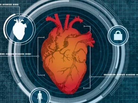 心臓の形でユーザーを見分けるレーダーによる生体認証--バッファロー大学が開発