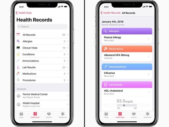 アップル、「Health Records API」を開発者らに公開