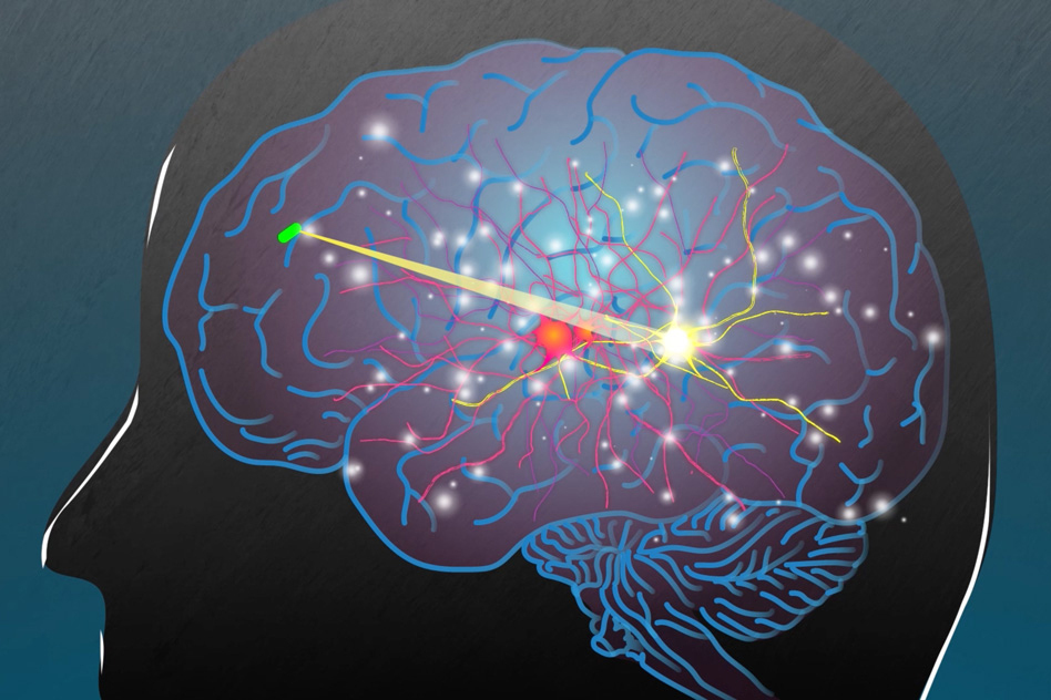 脳内で治療をするデバイス（出典：MIT）