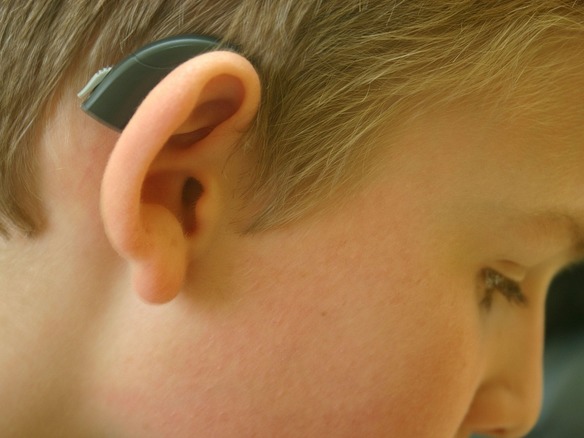 グーグル、「Android」で補聴器へのストリーミングをサポートへ