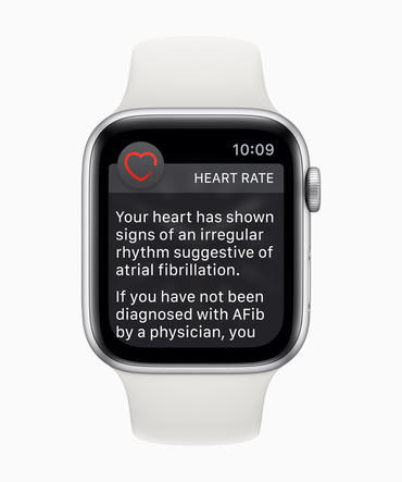 Apple Watchの心電図アプリ画面