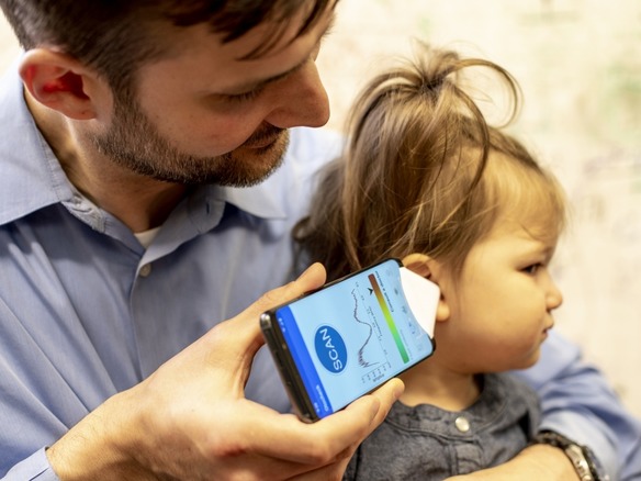 ワシントン大学、スマホで中耳炎などの疑いを検査できるアプリ--家庭でも簡単に