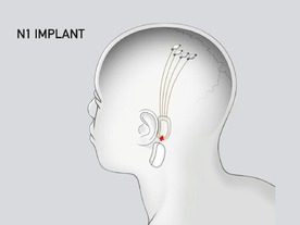 E・マスク氏のNeuralink、脳とコンピュータをつなぐ技術の臨床試験を2020年に開始へ