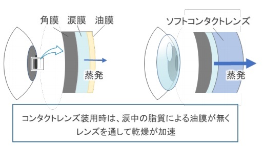 コンタクトレンズを装着すると目が乾く（出典：東北大学）
