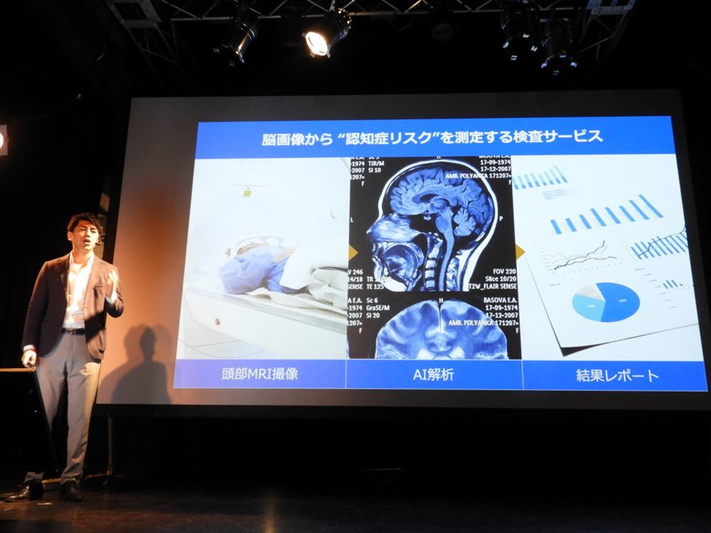 Splinkは脳のMRI画像から認知症のリスクを測定するAI医療機器の開発を進めている。