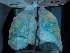 COVID-19が肺に与える影響をVRで--米病院がYouTube動画を公開