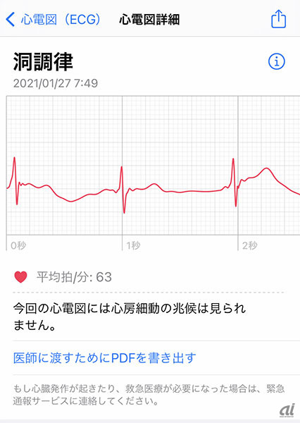 心電図の結果はiPhoneのヘルスケアアプリからも確認でき、iPhoneではPDFに書き出すこともできる