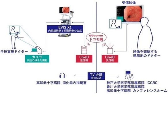  5G×遠隔医療--NTTドコモやオリンパスら、消化器内視鏡映像のリアルタイム伝送に成功