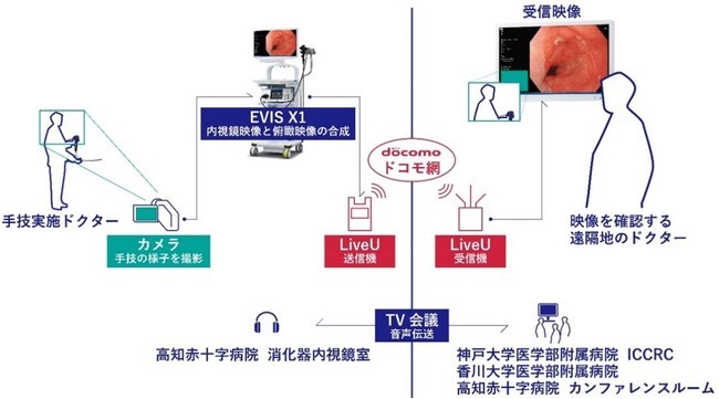 5g X Telemedicine Successful Real Time Transmission Of Gi Endoscopy Images By Ntt Docomo Olympus Etc Cnet Japan Nihongo News