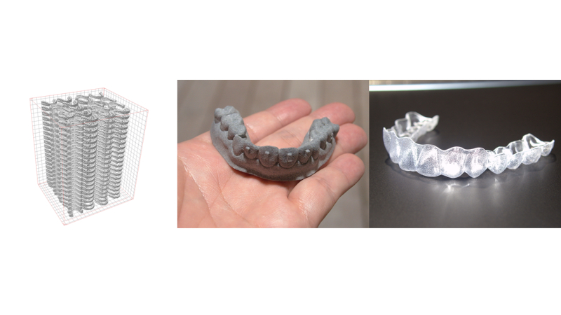 製作イメージ（左）、歯形模型（中央）、製作されたマウスピース（右）