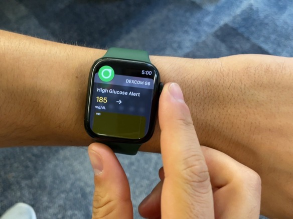 「Apple Watch」が命を守る--転倒検出、低血糖アラート、緊急SOSなど