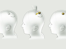 E・マスク氏、脳インプラント企業Neuralinkの進捗を10月31日に発表へ