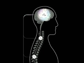 Neuralink、脳埋め込みデバイスの最新状況をサルとブタの実験で披露
