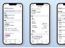 富士通と札幌医科大学--電子カルテとAppleのヘルスケアアプリが相互連携する取り組み