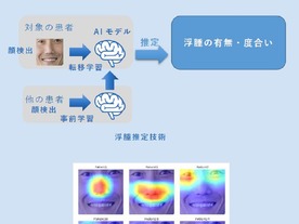 顔映像から浮腫の度合いを推定--NEC、世界初の技術を開発