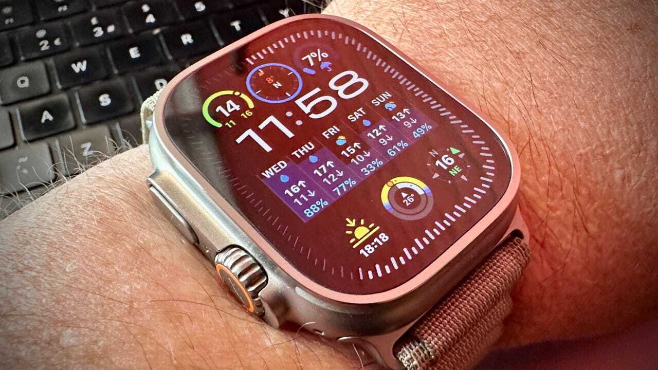 アップル、米国で「Apple Watch」2機種から血中酸素センサーを削除か 